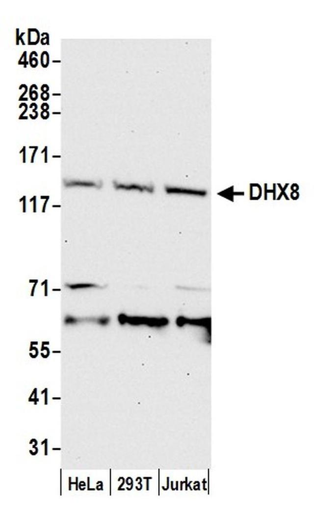 DHX8 Antibody in Western Blot (WB)