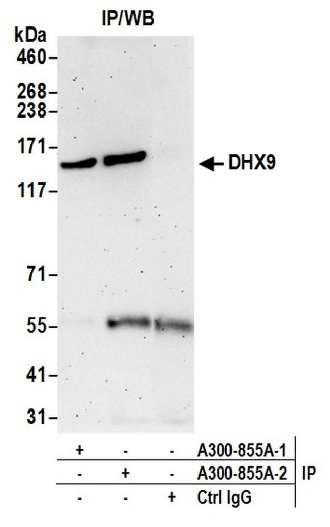 DHX9 Antibody in Western Blot (WB)