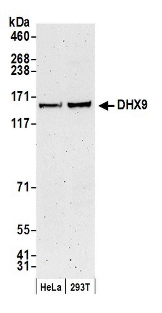 DHX9 Antibody in Western Blot (WB)