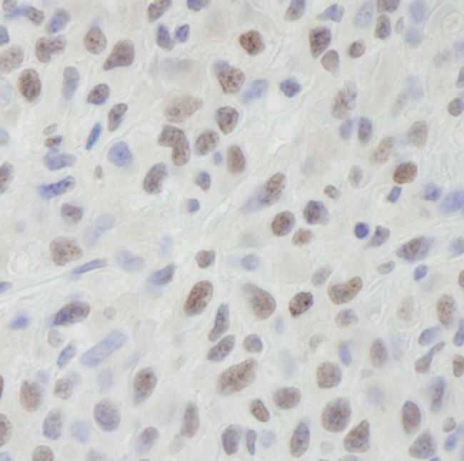 DHX9 Antibody in Immunohistochemistry (IHC)