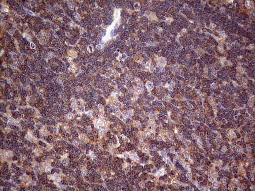 DICER1 Antibody in Immunohistochemistry (Paraffin) (IHC (P))