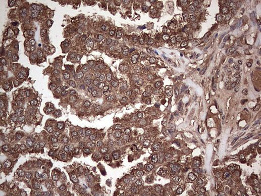 DICER1 Antibody in Immunohistochemistry (Paraffin) (IHC (P))