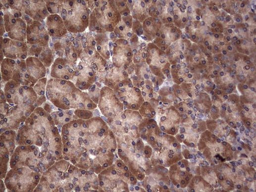 DICER1 Antibody in Immunohistochemistry (Paraffin) (IHC (P))