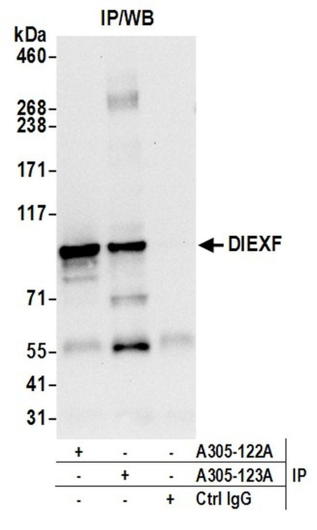 DIEXF/C1orf107 Antibody in Immunoprecipitation (IP)