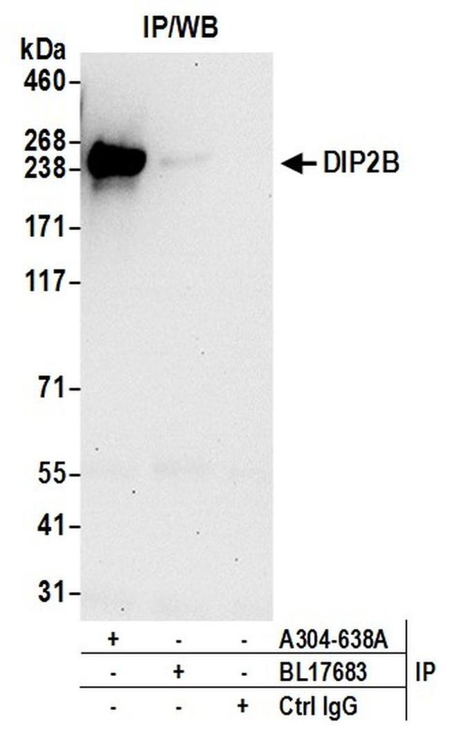 DIP2B Antibody in Western Blot (WB)