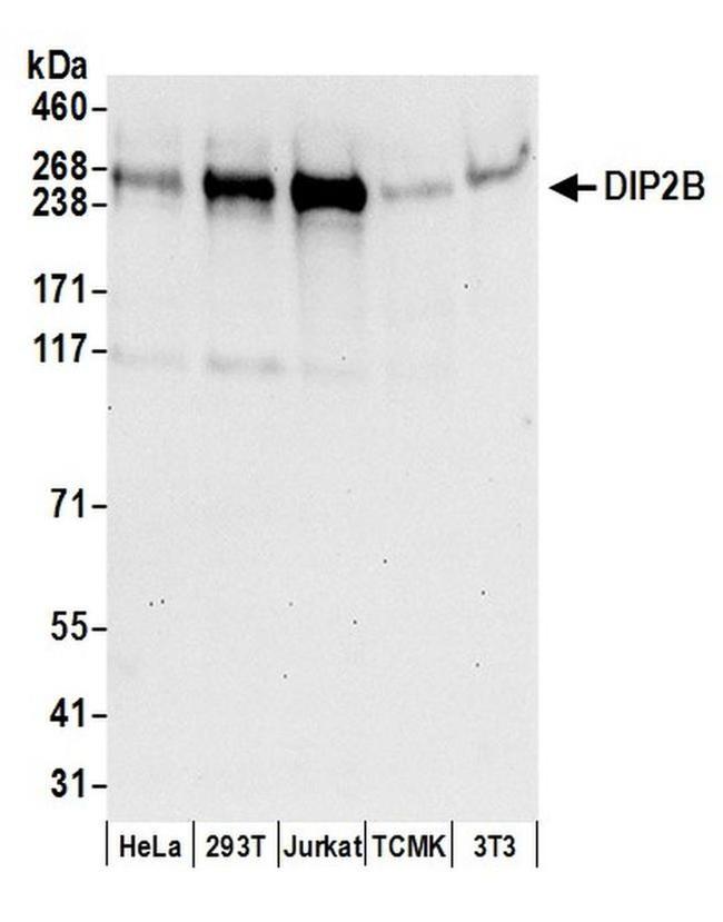 DIP2B Antibody in Western Blot (WB)