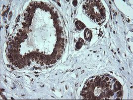 DIXDC1 Antibody in Immunohistochemistry (Paraffin) (IHC (P))