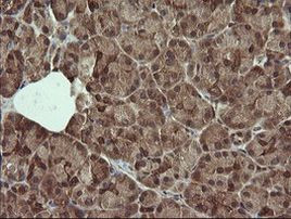 DIXDC1 Antibody in Immunohistochemistry (Paraffin) (IHC (P))