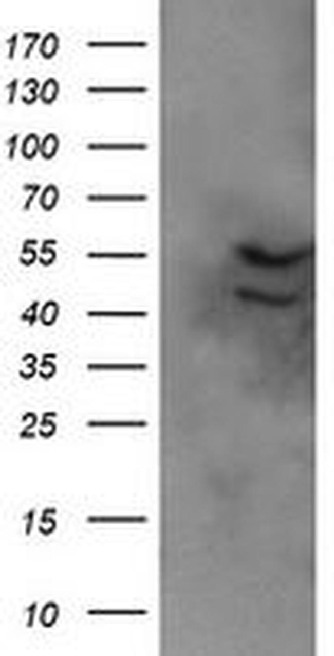 DIXDC1 Antibody in Western Blot (WB)