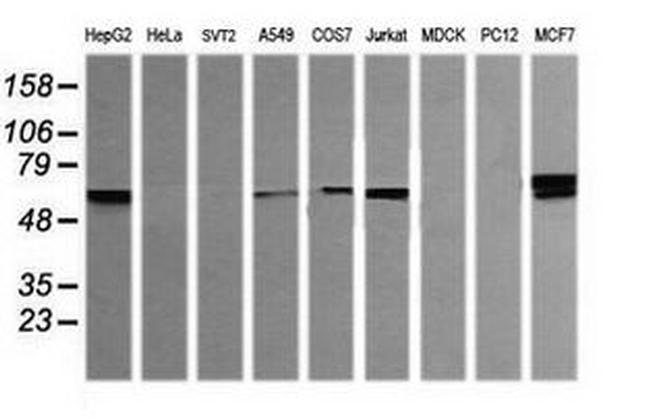 DIXDC1 Antibody in Western Blot (WB)