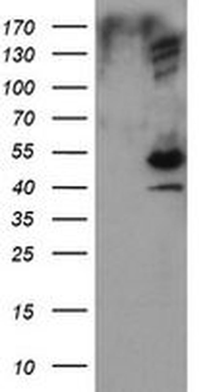 DIXDC1 Antibody in Western Blot (WB)