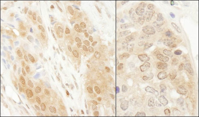 DJ-1 Antibody in Immunohistochemistry (IHC)