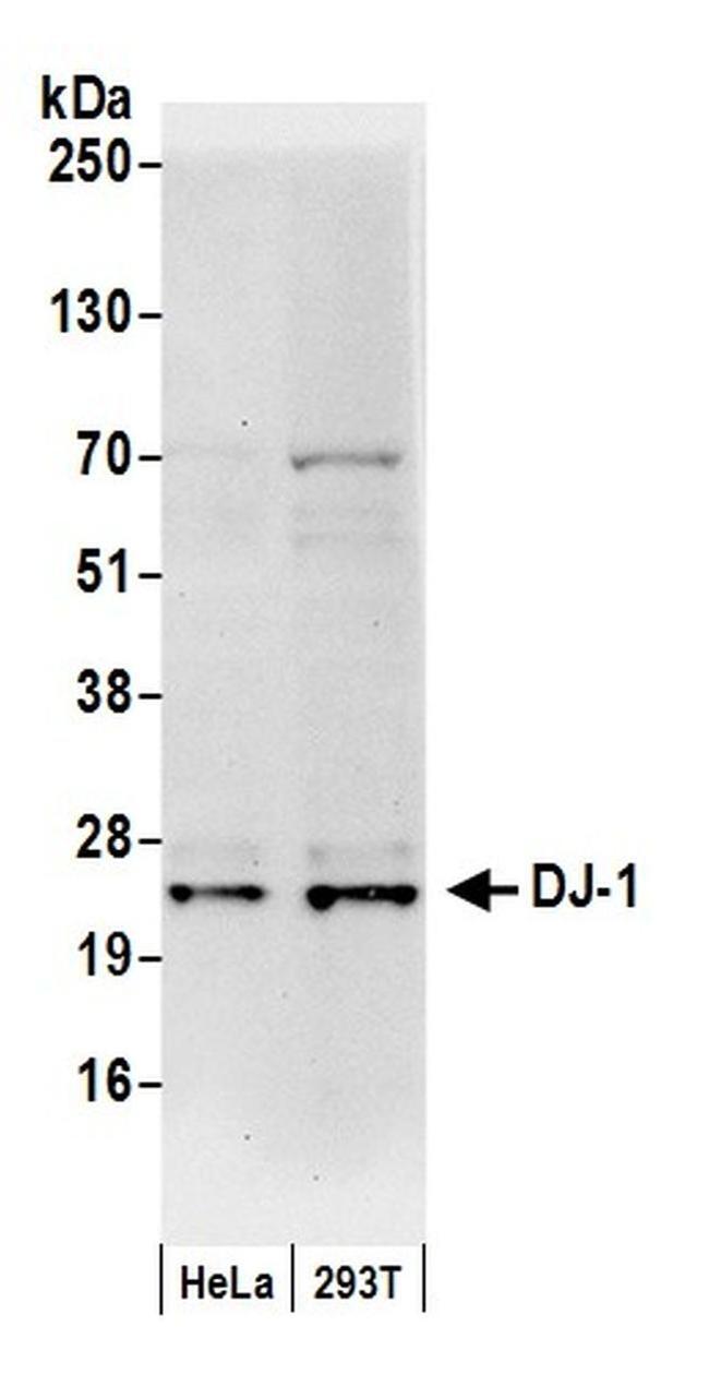 DJ-1 Antibody in Western Blot (WB)