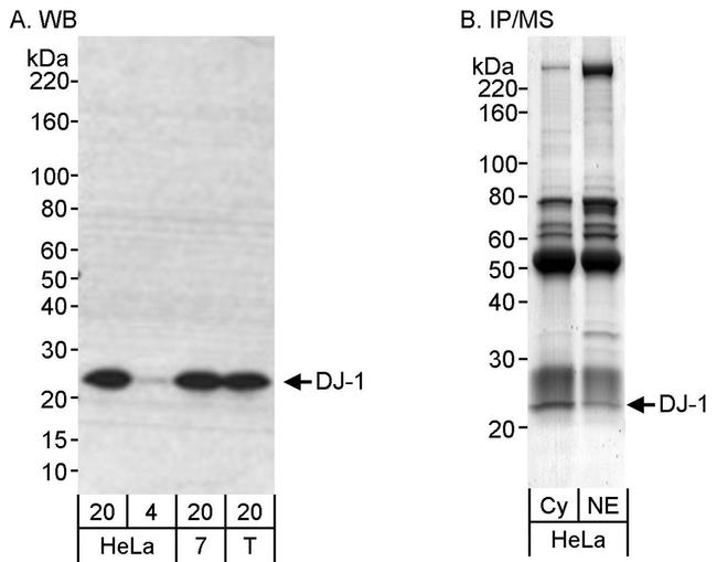 DJ-1 Antibody in Western Blot (WB)