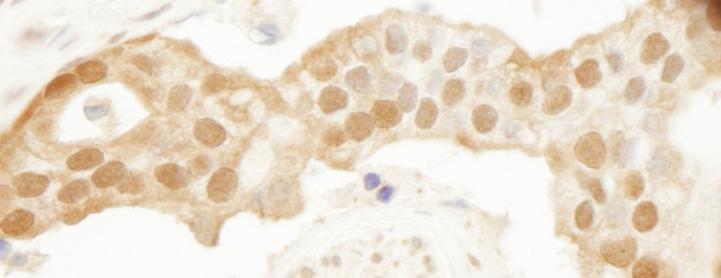 DJ-1 Antibody in Immunohistochemistry (IHC)