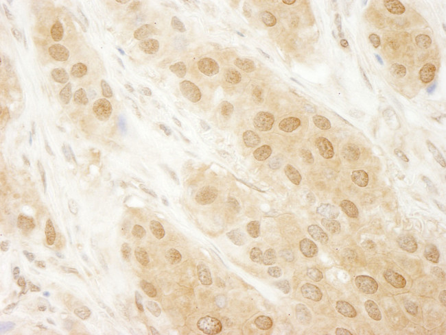 DJ-1 Antibody in Immunohistochemistry (IHC)