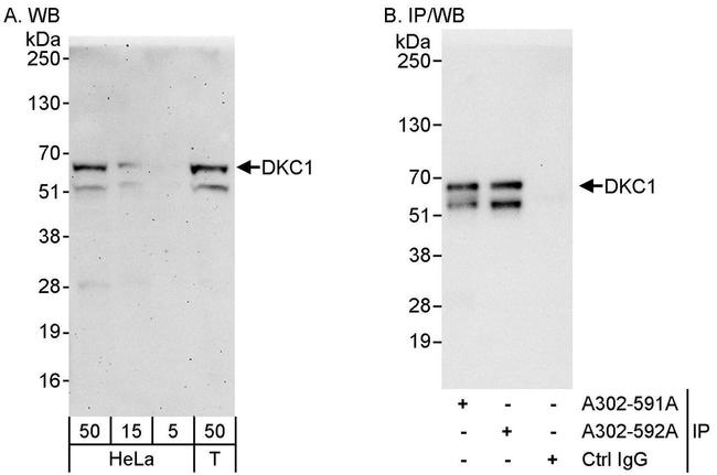 DKC1 Antibody in Western Blot (WB)