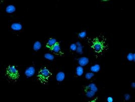 DLD Antibody in Immunocytochemistry (ICC/IF)