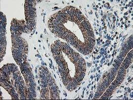 DLD Antibody in Immunohistochemistry (Paraffin) (IHC (P))