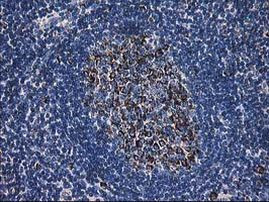 DLD Antibody in Immunohistochemistry (Paraffin) (IHC (P))