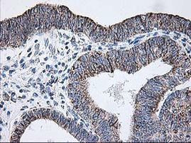 DLD Antibody in Immunohistochemistry (Paraffin) (IHC (P))