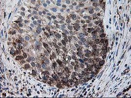 DLD Antibody in Immunohistochemistry (Paraffin) (IHC (P))