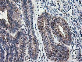 DLD Antibody in Immunohistochemistry (Paraffin) (IHC (P))