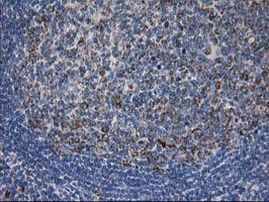 DLD Antibody in Immunohistochemistry (Paraffin) (IHC (P))