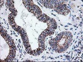 DLD Antibody in Immunohistochemistry (Paraffin) (IHC (P))