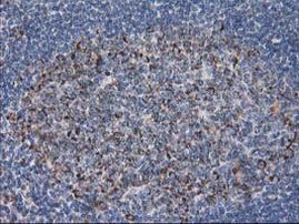 DLD Antibody in Immunohistochemistry (Paraffin) (IHC (P))