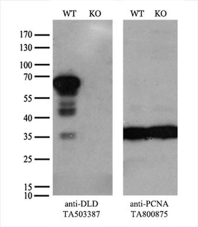 DLD Antibody in Western Blot (WB)