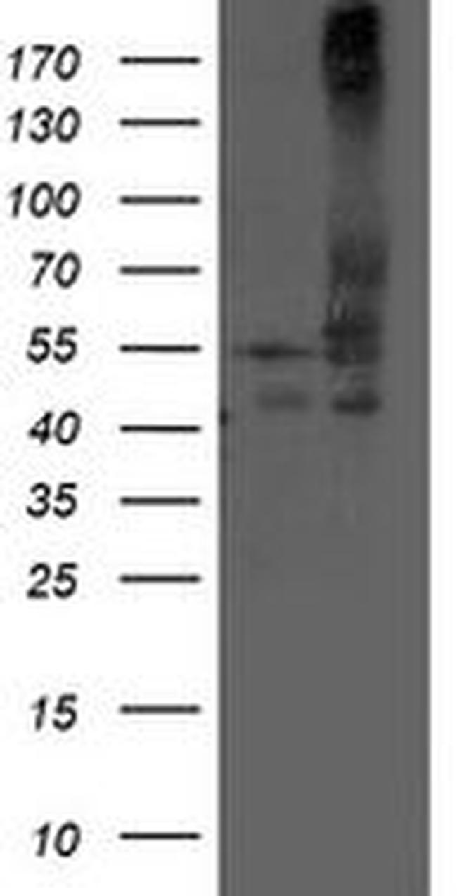 DLD Antibody in Western Blot (WB)