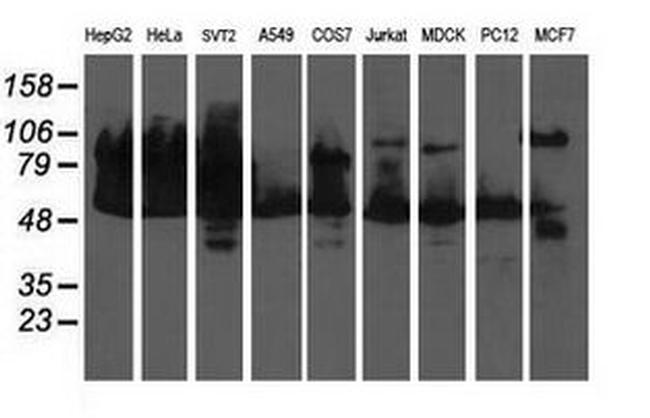 DLD Antibody in Western Blot (WB)