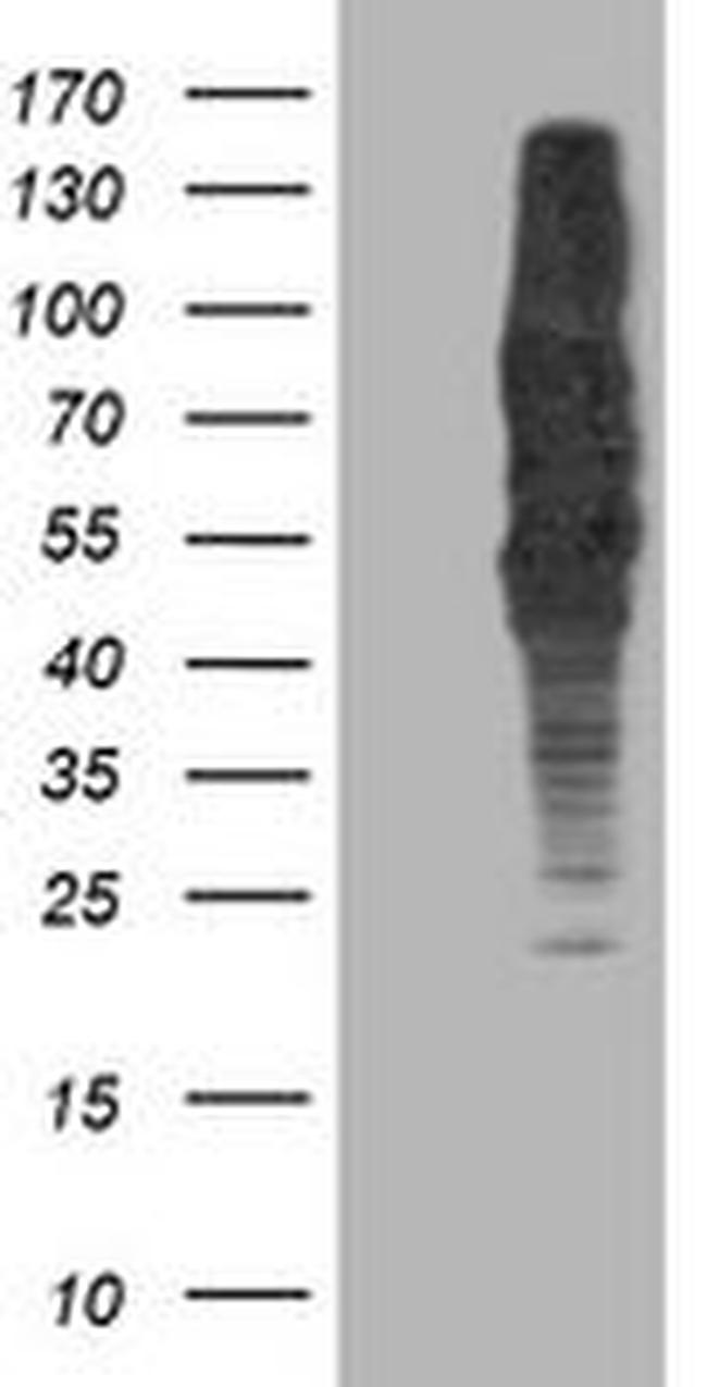 DLD Antibody in Western Blot (WB)