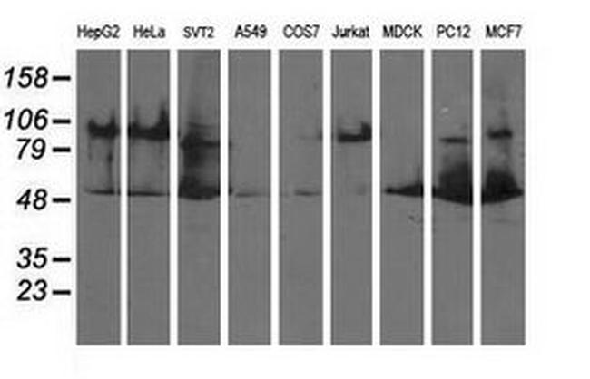 DLD Antibody in Western Blot (WB)