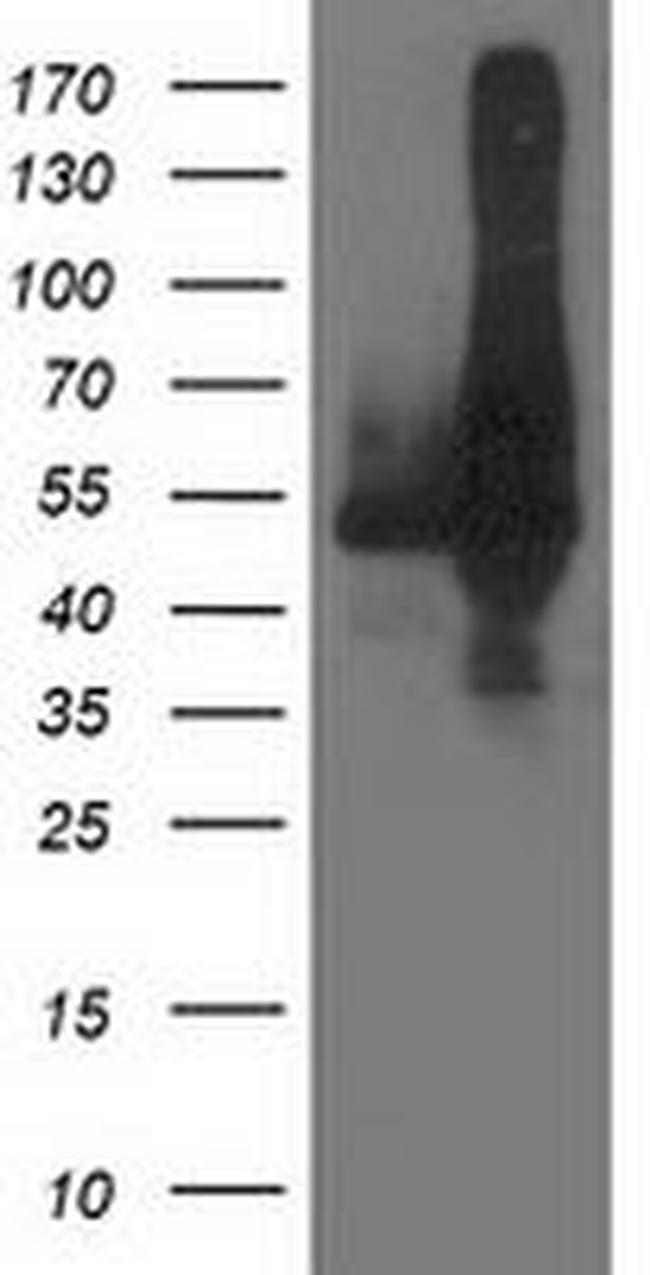 DLD Antibody in Western Blot (WB)