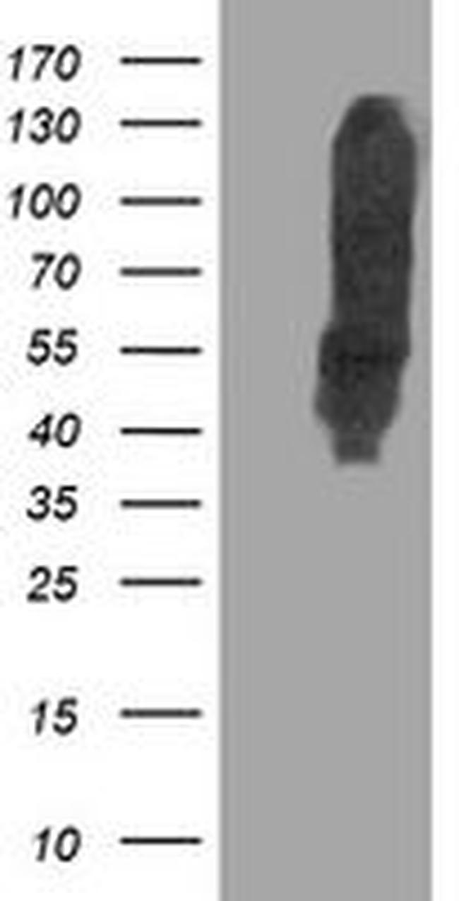 DLD Antibody in Western Blot (WB)