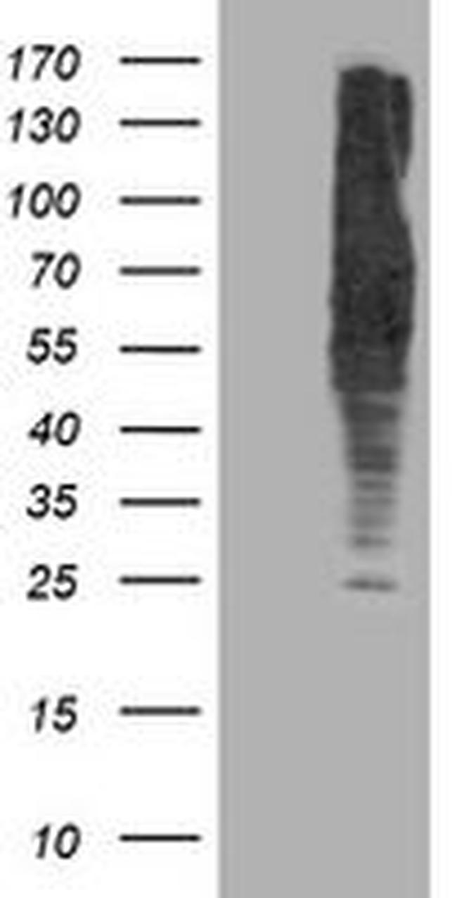 DLD Antibody in Western Blot (WB)