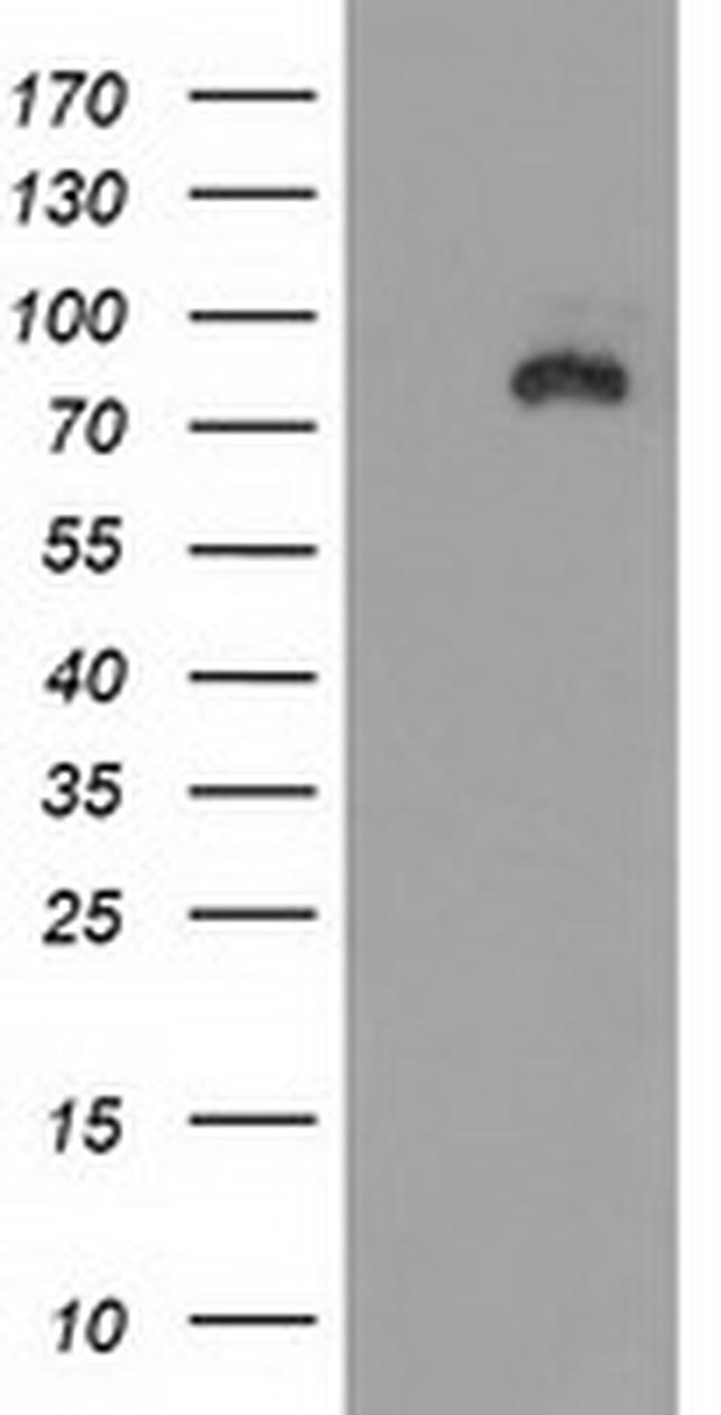 DLG3 Antibody in Western Blot (WB)