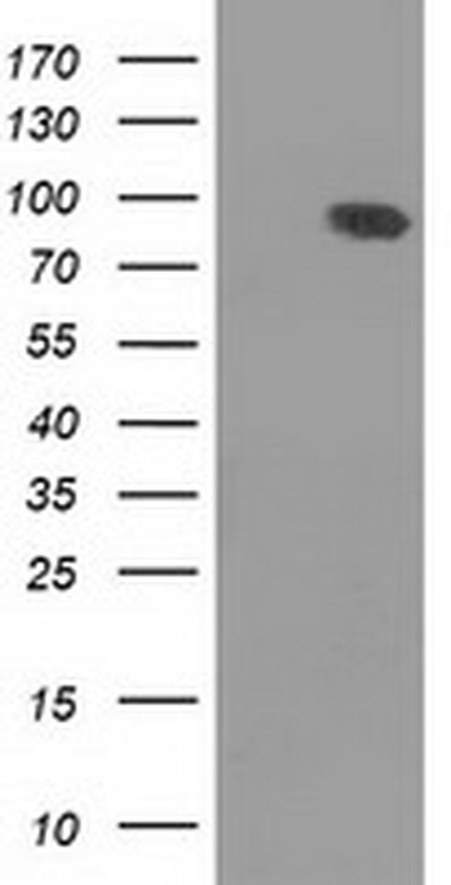 DLG3 Antibody in Western Blot (WB)