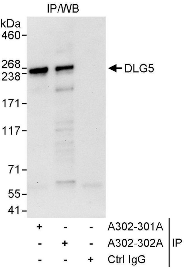 DLG5 Antibody in Immunoprecipitation (IP)