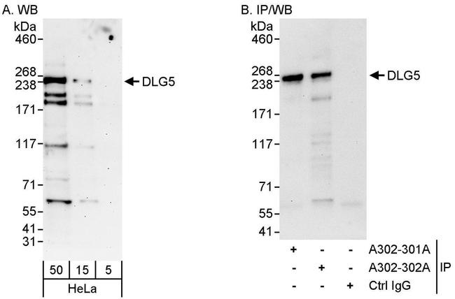 DLG5 Antibody in Western Blot (WB)