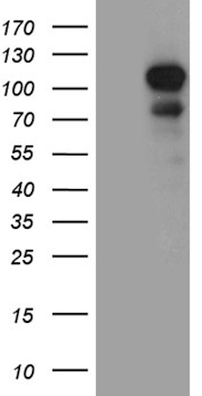 DLGAP3 Antibody in Western Blot (WB)