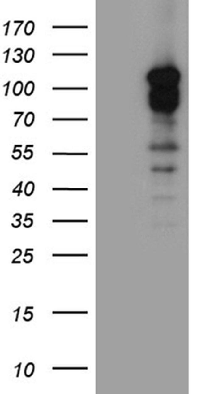 DLGAP3 Antibody in Western Blot (WB)