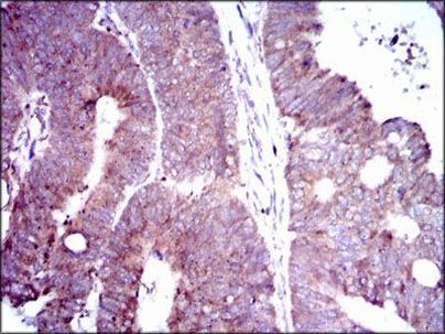 DLL4 Antibody in Immunohistochemistry (Paraffin) (IHC (P))