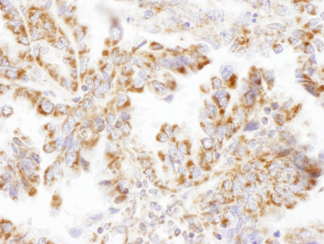 DLST Antibody in Immunohistochemistry (IHC)