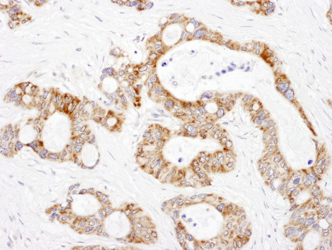 DLST Antibody in Immunohistochemistry (IHC)