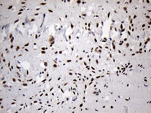 DLX1 Antibody in Immunohistochemistry (Paraffin) (IHC (P))