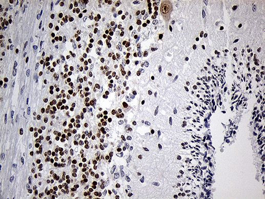 DLX1 Antibody in Immunohistochemistry (Paraffin) (IHC (P))