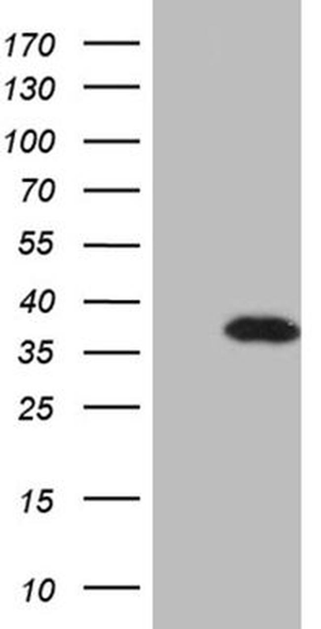 DLX1 Antibody in Western Blot (WB)